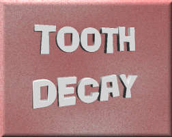Tooth Decay